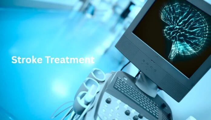 stroke treatment new tech TDB SV3 Technology
